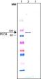 Propionyl-CoA Carboxylase Subunit Alpha antibody, PA1-27572, Invitrogen Antibodies, Western Blot image 
