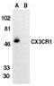 C-X3-C Motif Chemokine Receptor 1 antibody, LS-C325, Lifespan Biosciences, Western Blot image 