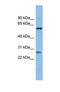 Chymotrypsinogen B1 antibody, NBP1-69669, Novus Biologicals, Western Blot image 