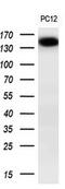 Transient Receptor Potential Cation Channel Subfamily M Member 4 antibody, GTX83491, GeneTex, Western Blot image 