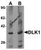Delta-like 1 homolog antibody, 7017, ProSci Inc, Western Blot image 