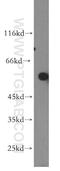 T-Box 5 antibody, 13178-1-AP, Proteintech Group, Western Blot image 