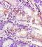 Platelet Derived Growth Factor Receptor Alpha antibody, orb103845, Biorbyt, Immunohistochemistry paraffin image 