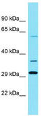 Solute Carrier Family 22 Member 25 antibody, TA334881, Origene, Western Blot image 