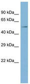 T-Complex-Associated-Testis-Expressed 1 antibody, TA337597, Origene, Western Blot image 