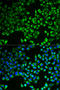 Citrate Synthase antibody, STJ28281, St John