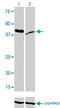 RAD23 Homolog A, Nucleotide Excision Repair Protein antibody, LS-C198053, Lifespan Biosciences, Western Blot image 