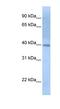 Inositol-Tetrakisphosphate 1-Kinase antibody, NBP1-56619, Novus Biologicals, Western Blot image 