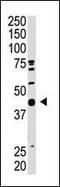 SUMO1 Activating Enzyme Subunit 1 antibody, PA5-12193, Invitrogen Antibodies, Western Blot image 