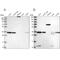 VPS37B Subunit Of ESCRT-I antibody, NBP2-38398, Novus Biologicals, Western Blot image 