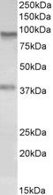PDLI2 antibody, 43-203, ProSci, Western Blot image 