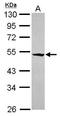 RasGEF Domain Family Member 1A antibody, GTX120514, GeneTex, Western Blot image 