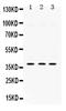 Protein Kinase AMP-Activated Non-Catalytic Subunit Beta 1 antibody, PB9738, Boster Biological Technology, Western Blot image 