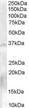 Nanos C2HC-Type Zinc Finger 1 antibody, EB06680, Everest Biotech, Western Blot image 