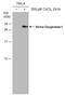 Heme Oxygenase 1 antibody, GTX633676, GeneTex, Western Blot image 