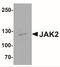 Janus Kinase 2 antibody, NBP2-41310, Novus Biologicals, Western Blot image 