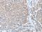 ADAM Metallopeptidase Domain 20 antibody, LS-C401177, Lifespan Biosciences, Immunohistochemistry frozen image 