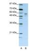 Seryl-TRNA Synthetase antibody, NBP1-57538, Novus Biologicals, Western Blot image 