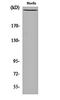 Filamin A antibody, orb159705, Biorbyt, Western Blot image 