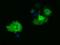 Phosphoribosylaminoimidazole Carboxylase And Phosphoribosylaminoimidazolesuccinocarboxamide Synthase antibody, GTX83949, GeneTex, Immunocytochemistry image 