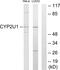 Cytochrome P450 Family 2 Subfamily U Member 1 antibody, PA5-38908, Invitrogen Antibodies, Western Blot image 