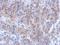 Katanin Catalytic Subunit A1 Like 1 antibody, GTX120095, GeneTex, Immunohistochemistry paraffin image 