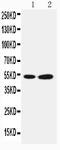 Selenium-binding protein 1 antibody, PA2216, Boster Biological Technology, Western Blot image 