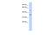 Family With Sequence Similarity 81 Member B antibody, A17087, Boster Biological Technology, Western Blot image 