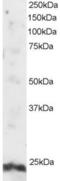 ADP Ribosylation Factor Like GTPase 4A antibody, 45-286, ProSci, Enzyme Linked Immunosorbent Assay image 