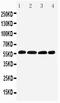 Interferon Regulatory Factor 5 antibody, PA2208, Boster Biological Technology, Western Blot image 