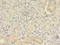 Sca3 antibody, A50069-100, Epigentek, Immunohistochemistry paraffin image 