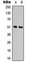 Adrenoceptor Alpha 1A antibody, orb315751, Biorbyt, Western Blot image 