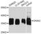 G Protein Subunit Alpha I2 antibody, STJ29989, St John