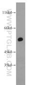 Retinoid X Receptor Alpha antibody, 21218-1-AP, Proteintech Group, Western Blot image 