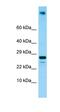 Ribosomal Protein L23a antibody, orb325251, Biorbyt, Western Blot image 