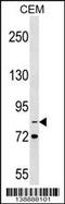 Integrin Subunit Beta 2 antibody, 59-655, ProSci, Western Blot image 