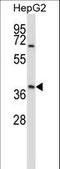 Alpha-1-Microglobulin/Bikunin Precursor antibody, LS-B9343, Lifespan Biosciences, Western Blot image 