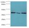 Eukaryotic Translation Initiation Factor 3 Subunit H antibody, LS-C375641, Lifespan Biosciences, Western Blot image 