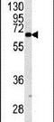 Keratin 9 antibody, PA5-14195, Invitrogen Antibodies, Western Blot image 