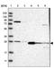 Steroidogenic Acute Regulatory Protein antibody, NBP1-86992, Novus Biologicals, Western Blot image 