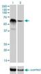 RNA Binding Motif Protein 5 antibody, H00010181-M01, Novus Biologicals, Western Blot image 