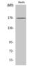 SWI/SNF complex subunit SMARCC2 antibody, PA5-50917, Invitrogen Antibodies, Western Blot image 