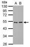 General Transcription Factor IIA Subunit 1 antibody, GTX117420, GeneTex, Western Blot image 