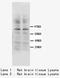 Protein Kinase C Gamma antibody, LS-C172039, Lifespan Biosciences, Western Blot image 
