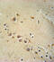 RAS guanyl-releasing protein 1 antibody, 62-074, ProSci, Immunohistochemistry paraffin image 