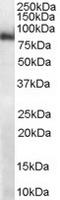 Midline 2 antibody, TA302853, Origene, Western Blot image 