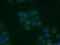 Vesicle Associated Membrane Protein 1 antibody, 13115-1-AP, Proteintech Group, Immunofluorescence image 