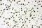 AKT Serine/Threonine Kinase 2 antibody, PB9043, Boster Biological Technology, Immunohistochemistry frozen image 