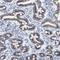 Transmembrane Protein 17 antibody, HPA018100, Atlas Antibodies, Immunohistochemistry frozen image 