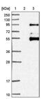 Sorbin And SH3 Domain Containing 3 antibody, PA5-53390, Invitrogen Antibodies, Western Blot image 